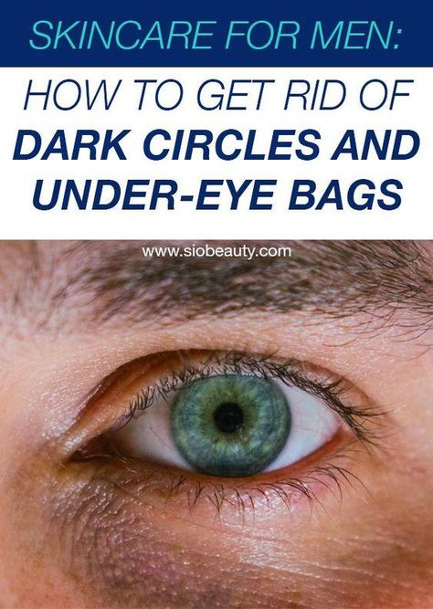 Sunken Eyes Remedy, Eye Bag Remedies, Undereye Bags, Skin Care For Men, Skincare For Men, Remove Eye Bags, Sunken Eyes, Men's Skincare, Dark Circles Under Eyes