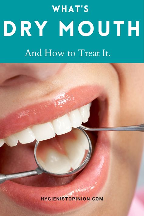 Dry Mouth. It can happen to anyone. It's uncomfortable and can be a sign of a serious health issue. Learn more and how to treat it. Dry Mouth Remedies How To Get Rid, Dry Mouth Remedies, Remedies For Dry Mouth, Baby Tooth Decay, Mouth Care, Tartar Removal, Tooth Repair, Dry Mouth, Oral Care Routine