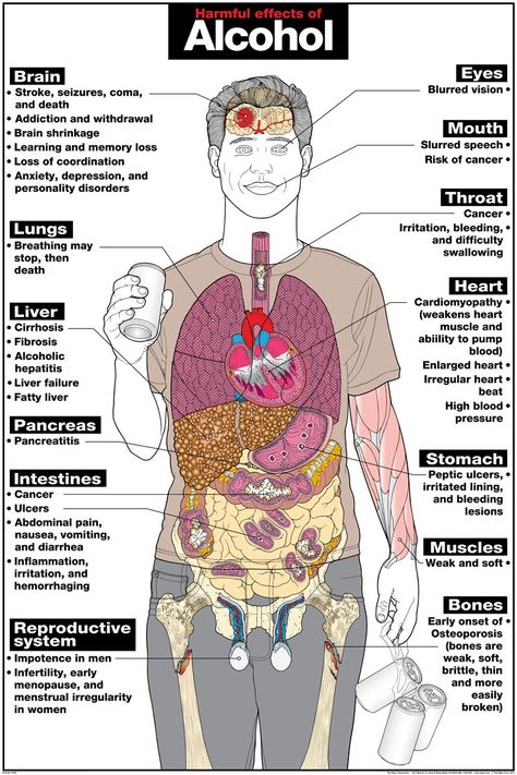 Alcohol Poster, Effects Of Alcohol, Red Ribbon Week, Health Class, Awareness Poster, Brain Damage, Therapy Tools, The Human Body, Therapy Activities