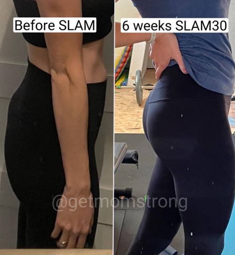 Flat Buttocks Before And After, Types Of Butts, But Lifting Jeans, Flat Buttocks, Best Exercises To Lift Buttocks, Flat But To Bubble But, Pregnancy Glute Workout, Glute Medius, Gluteus Medius