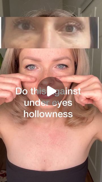 Plump Under Eyes, Fine Lines Under Eyes, Under Eye Hollows Remedies, How To Fix Hollow Under Eyes, Hollow Under Eyes Remedies, Hollow Eyes Exercise, Under Eye Hollows Exercise, Eye Filler, Hollow Eyes Remedy