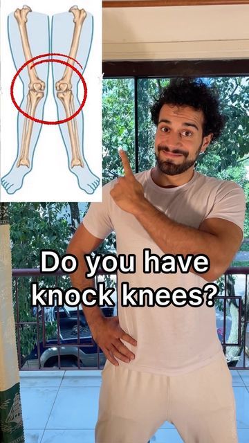 Knee Pain Remedies, Knock Knees Exercises, Knock Knees, Leg Workout Routine, Knee Pain Exercises, Yoga Beginners, Quick Workout Routine, Abs And Cardio Workout, Knee Exercises