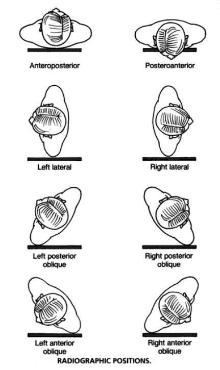 positioning terminology Diagnostic Radiography, Radiography Student, Surgical Technologist Student, Rad Tech Student, Radiology Schools, Medical Radiography, Radiology Humor, Radiologic Technology, Radiology Student