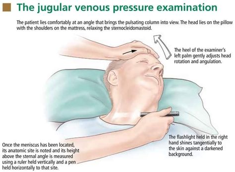 Jugular Venous Pressure, Nursing School, Nursing, Hold On, Medical, Skin, Quick Saves