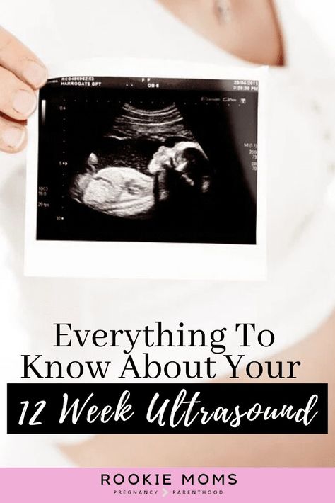 Everything to Know about Your 12 Week Ultrasound! Will you find out your baby's gender?  Are you due to have your 12 week ultrasound and don't know what to expect? Check this ultimate guide to get all the information that you need. #pregnancy #pregnancytips #motherhood 12 Week Ultrasound Pictures, 12 Week Ultrasound Gender, 12 Week Ultrasound, How To Get Energy, First Trimester Workout, Pregnancy Quotes Funny, Trimester By Weeks, 12 Weeks Pregnant, Pregnancy Ultrasound