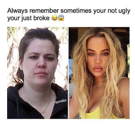 Disabled Models, Kardashian Memes, Fashion Evolution, Celebrities Then And Now, Nose Job, Fit Chicks, Kardashian Jenner, Khloe Kardashian, New Face