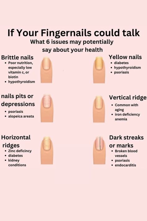 Fingernail Health, Nail Disorders, Sleeping Well, Diy Beauty Treatments, Poor Nutrition, Health Signs, Nail Care Routine, Brittle Nails, Strong Nails