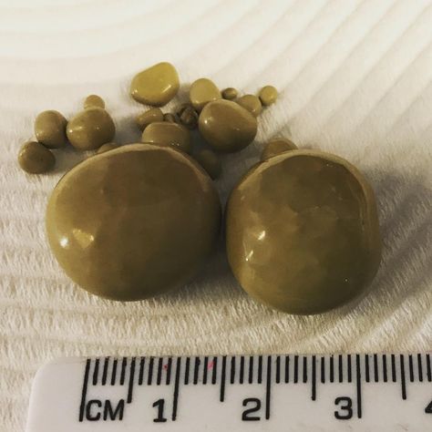 No this is not a new type of jewellery, it’s bladder stones! These stones were removed from a dogs bladder during a surgery called a… Bladder Stones, Surgery, Stone, Dogs