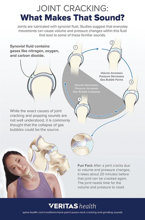 Cracking Bones, Forward Head Posture Exercises, Neck Cracking, Throbbing Headache, Neck And Shoulder Muscles, Forward Head Posture, Synovial Fluid, Ligaments And Tendons, Posture Exercises