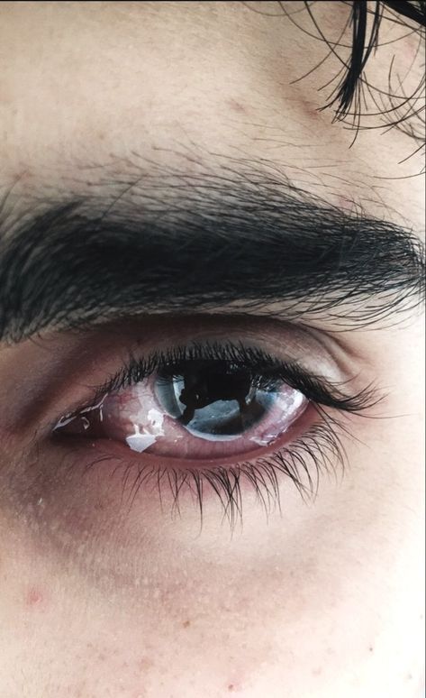 An Eye, The Eye, Blue Eyes, Black Hair, A Man, Close Up, Red, Hair, Blue