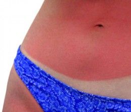 How to get a tan with fair skin. I NEED TO REPIN THIS Home Remedies For Sunburn, Sunburn Remedies, Sunburn Relief, Pale Skin, Fair Skin, Health And Beauty Tips, Beauty Secrets, Diy Beauty, Home Remedies