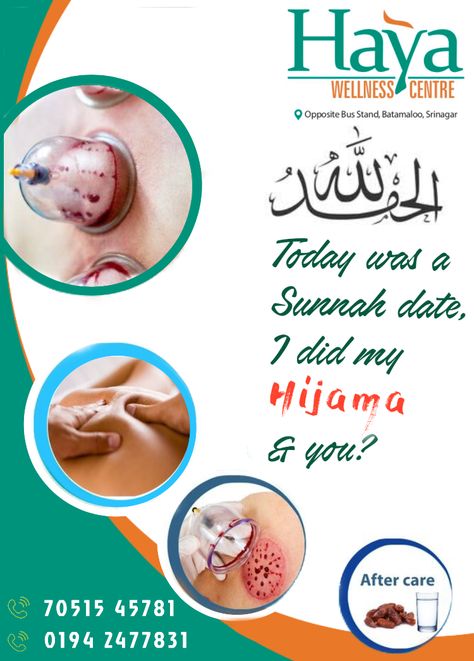 Hijama Therapy Hijama Cupping Therapy Poster, Hijama Cupping Therapy Logo, Hijama Points, Cupping Points, Hijama Cupping Therapy, Hijama Cupping, Massage Cupping, Powerpoint Animation, Funny Instagram Captions