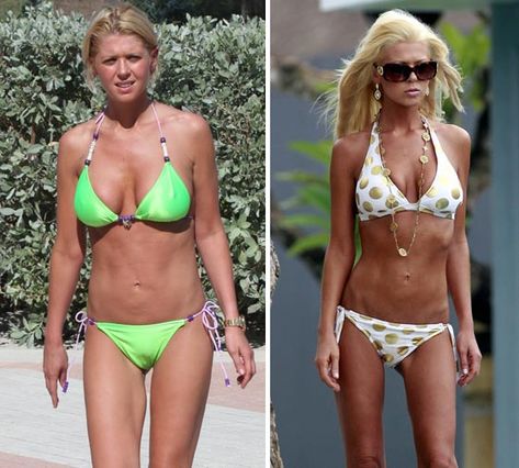 Actress Tara Reid bounces back into shape after pictures of her skeletal figure sparked health fears. #2008.10.20. #tarareid #bikinbody Tara Reid Now, Virgo Images, Zodiac Stories, Tara Reid, Tara Reed, Pisces Man, Ali Larter, Rachel Mcadams, After Pictures