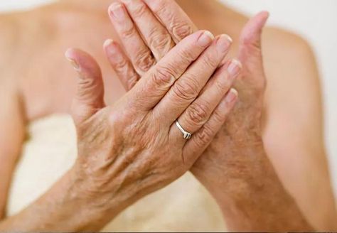 How To Make Your Hands Look Younger How To Make My Hands Look Younger, How To Keep Hands Youthful, How To Make Hands Look Younger, Make Hands Look Younger, Skin Removal Surgery, Hand Care Routine, Creepy Skin, Lanolin Cream, Laser Resurfacing