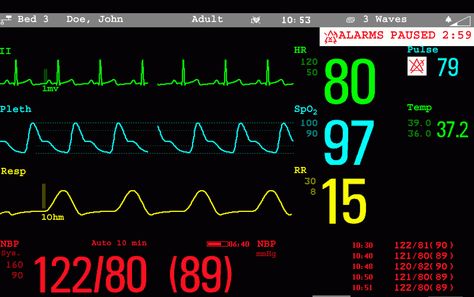 Vital Signs Monitor, Low Estrogen Symptoms, Xander Cage, Return Of Xander Cage, Too Much Estrogen, Heart Monitor, Low Estrogen, Protein Pudding, Estrogen Dominance