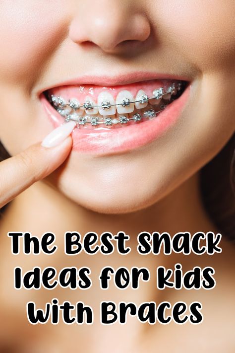 snacks for kids with braces Soft Foods After Getting Braces, Soft Foods After Braces Ideas, Easy Meals For Braces, School Lunch Ideas For Kids With Braces, Good Foods To Eat With Braces, Best Food To Eat With Braces, What To Eat After Braces, Soft Food Braces Ideas, Brace Friendly Recipes