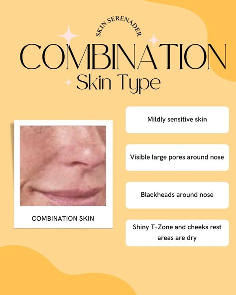 Discover Your Skin Type for Flawless Skin! ✨ Not sure if you have oily, dry, combination, or sensitive skin? Swipe through this ultimate skin type guide to find out and get personalized skincare tips for a radiant complexion! 🌟 #skintype #skincareroutine . . . . . #skintypeguide #howtoknowyourskintype #skincaretips #skincareforyourhair #knowyourskin #glowingskin #healthyskin #beautytips #skincareroutine #selfcaresunday #skincareessentials #complexionperfection #beautyroutine #skincarecommu... Skincare For Combination Skin, Night Time Skin Care Routine, Collagen Mask, Combination Skin Type, Skin Detox, Perfect Complexion, Sensitive Skin Care, Dry Eyes, Skincare Tips