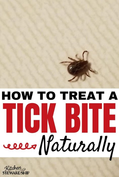 Tick Bites Pictures, How To Remove Ticks From People, Essential Oils For Tick Bites, Deer Tick Bite, Tick Spray Essential Oils, Tick Bite Symptoms, Essential Oils For Ticks On Dogs, How Do You Remove A Tick From A Dog, Types Of Ticks