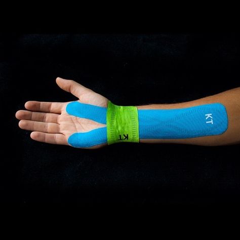 There are many causes for carpal tunnel. The most well known is compression of the median nerve at the wrist. Therapies such as taping, soft tissue therapy, adjustments, ultrasound and laser can be effective tools to care for this condition. Other areas of interest that can give carpal tunnel like syndromes are entrapment in the muscles of the forearm, elbow dysfunction, shoulder dysfunctions and most often poor biomechanics in the lower neck. Kt Tape For Carpal Tunnel, Carpal Tunnel Exercises, Carpal Tunnel Relief, Carpel Tunnel, K Tape, Apocalypse Fashion, Kinesio Tape, Kt Tape, Kinesio Taping