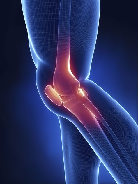 Partial Knee Replacement, Stem Cell Therapy, Knee Replacement, Joints Pain Relief, Leg Pain, Hip Pain, Knee Injury, Manhattan Beach, Muscle Pain