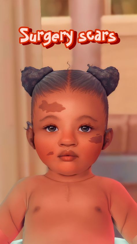 ♥ Infants CC conversions - disABILITIES ♥ | BubblySimsie on Patreon Sims 4 Infant Makeup, Sims4 Infant Skin Cc, Sims 4 Cc Kids Makeup, Ts4 Infant Cc Skin, Infant Skin Details Sims 4, Ts4 Infants Cc, Infant Cc Sims 4 Skin, Sims 4 Infant Skin Details, Sims 4 Infant Cc Skin Details