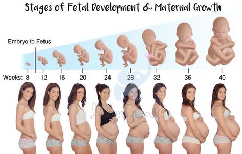 Stages Of Fetal Development, Pregnancy Over 40, 4 Months Pregnant, First Month Of Pregnancy, Prego Outfits, Medical Drawings, Pregnancy Facts, Stages Of Pregnancy, Ultrasound Technician