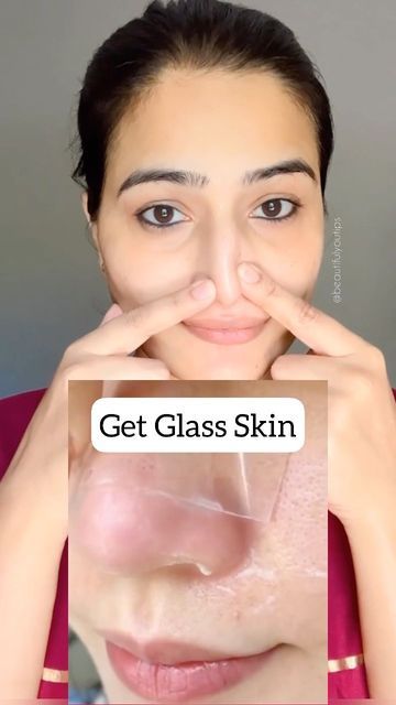 How To Get Rid Of Whiteheads On Nose, How To Make Ur Skin Glow, Open Pores On Face How To Get Rid, Whiteheads On Chin, Chin Whiteheads, Gram Flour Face Mask, How To Remove Whiteheads, Remove Whiteheads, Open Pores On Face