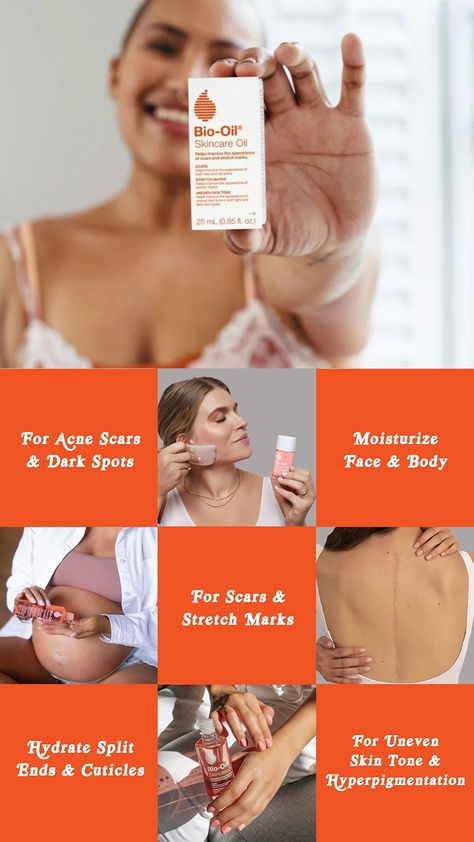 Discover the wonders of Bio-Oil Skincare Body Oil, a Vitamin E-rich serum designed specifically for pregnant women. #BioOilSkincare #PregnancySkincare #StretchmarkRemedy #ScarsTreatment #VitaminEserum #BodyOilMoisturizer #PregnancyBeauty #MaternitySkincare #AllSkinTypes #BioOilBenefits #PregnancyGlow #HealthySkinDuringPregnancy #BioOil2oz #PregnancySelfCare #BioOilResults #NaturalSkincare #PregnancyBodyCare #BioOilReview #SafeForPregnancy #BioOilForMoms Vitamin E Serum, Bio Oil Skin, Moisturizing Body Oil, Pregnancy Skincare, Bio Oil, Oil Skin Care, Flawless Skin, Body Moisturizer, Radiant Skin