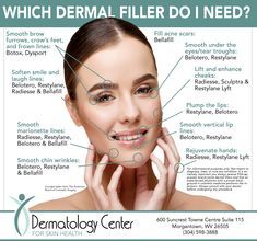 Comparing Different Types of Facial Fillers Chin Wrinkles, Botox Injection Sites, Types Of Facial, Restylane Lyft, Face Fillers, Types Of Facials, Facial Anatomy, Facial Fillers, Cosmetic Injectables