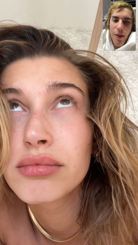 Hailey Bieber Nose, Big Nose Beauty, Hailey Bieber Style, Hailey Baldwin Style, Justin Hailey, Lip Beauty, Lip Fillers, Hailey Baldwin, Hailey Bieber