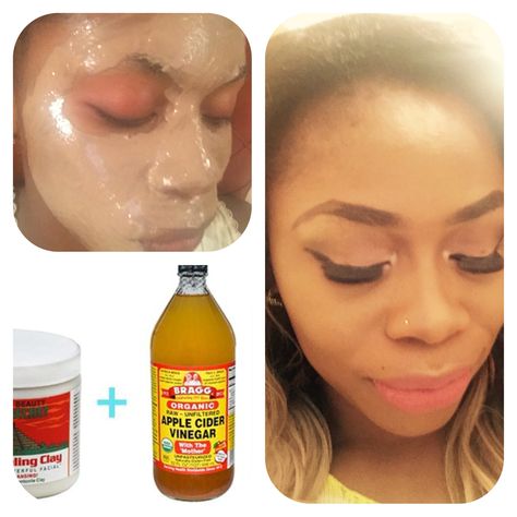 The best face mask for acne to smooth skin. 1tbs ACV, 1tbs bentonite clay 1tbs honey 1tbs lemon juice Mix to form a paste if too thick add 1-2tbs of water Apply to freshly wash face n leave on for 10-15mins Wash off with cold water n moisturize. Do dis 2x a week  And enjoy you spotless baby skin face. Face Mask For Acne, Mask For Acne, Thirtieth Birthday, Natural Hair Transitioning, Hair Transition, Tips For Skin, Wash Face, Health Hair, Woman Hair