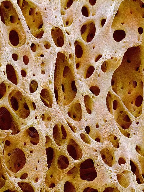 Cancellous Bone, Bone Tissue, Scanning Electron Micrograph, Microscopic Images, Human Anatomy And Physiology, Stem Cell Therapy, Body Scanning, Complex Systems, Science Photos