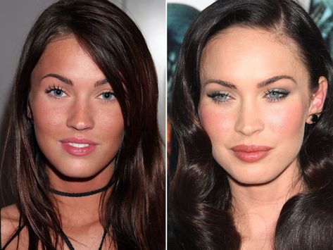 Megan Fox before and after #botoxbeforeandafter Megan Fox Face, Face Plastic Surgery, Cheek Implants, Plastic Surgery Photos, Facial Fillers, Nose Surgery, Celebrity Plastic Surgery, Fox Face, Celebrities Before And After