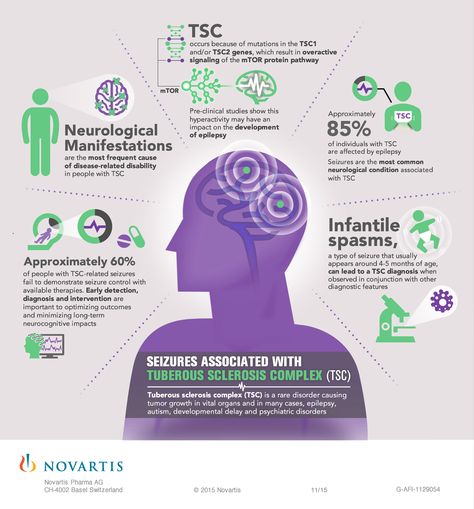 Seizures Associated with Tuberous Sclerosis Complex (TSC) Tuberous Sclerosis, Medical Anatomy, Rare Disease, Neurology, Things To Know, Natural Health, Natural Remedies, Anatomy, Disease