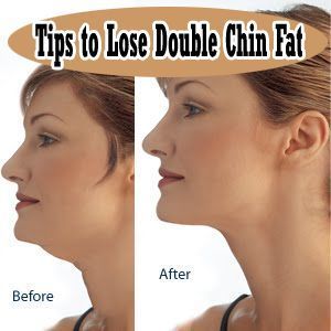 tips to lose double chin fat Loose Neck Skin, Double Chin Exercises, Chin Exercises, Double Menton, Face Exercises, Facial Exercises, Double Chin, Sport Motivation, Health And Beauty Tips