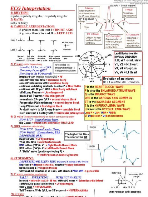 ECG Interpretation Cheat Sheet - Download as PDF File (.pdf), Text File (.txt) or read online. Nursing School Studying Cheat Sheets, Emt Study, Ekg Interpretation, Ecg Interpretation, Paramedic School, Nursing Cheat, Nursing School Essential, Nursing Study Guide, Medicine Notes