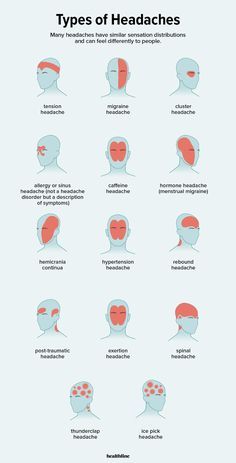 Types Of Headaches Chart, Headache Meaning, Headache Location, Headache Chart, Different Types Of Headaches, Different Headaches, Headache Causes, Throbbing Headache, Headache Types