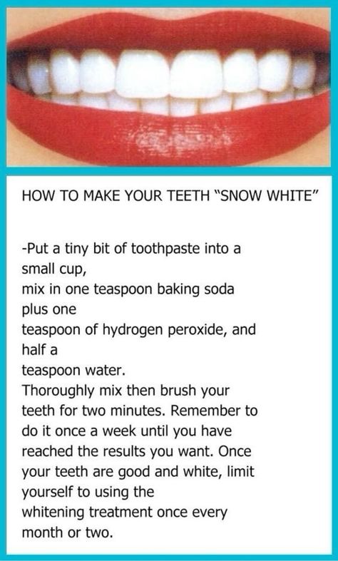 HOW TO MAKE YOUR TEETH "SNOW WHITE" Tooth Whitening, Teeth Whitening Diy, Bus Stand, Diy Teething, Yellow Teeth, Best Teeth Whitening, Natural Teeth Whitening, Maddie Ziegler, Natural Teeth