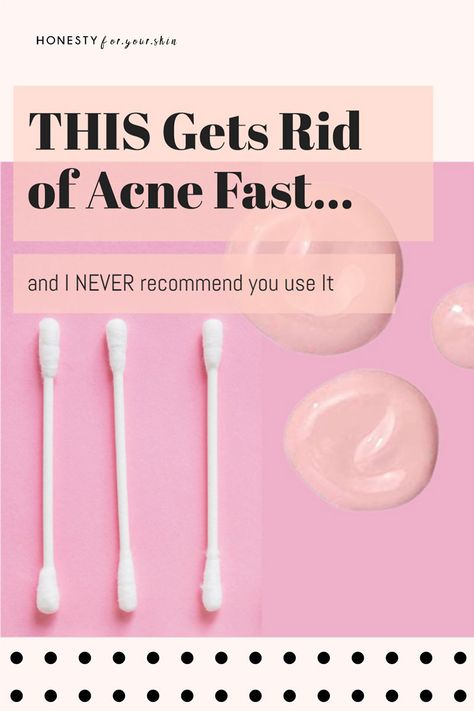 Is it good to dry out acne? Is it better to dry out or moisturize a pimple? Should I use a drying lotion to get rid of acne fast? This is the scientific answer. #acne #acnetreatment #honestyforyourskin Get Rid Of Acne Fast, Acne Positivity, Dry Acne Prone Skin, Dry Out Pimples, Drying Lotion, Skincare Solutions, Skincare Habits, Pimples Remedies, Acne Skincare