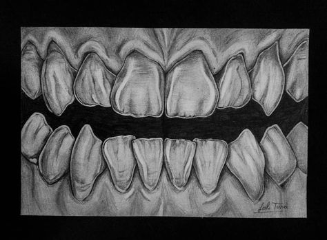 Teeth And Gums Drawing, Teeth Sketch Anatomy, Denture Drawing, Dental Anatomy Drawing, Teeth Drawings, Dental Drawings, Sharp Teeth Drawing, Teeth Sketch, Teeth Drawing Reference