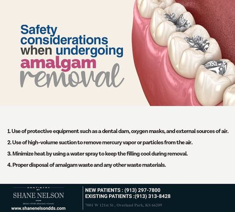 Are you worried about mercury exposure during amalgam removal? At Shane Nelson DDS, we utilize state-of-the-art technology and protocols to put your mind at ease. #safeamalgamremoval #mercuryfreedentistry #shanenelsondds #overlandpark #KS Amalgam Fillings, Dental Spa, Oxygen Mask, Dental Center, Overland Park, Water Spray, Cosmetic Dentistry, Art Technology, Dental Health