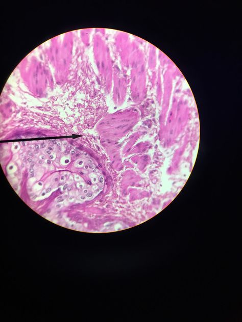 Transitional epithelium looks like it is composed of simple squamous and simple cuboial cells but it has bumps in the top layer. This allows for waterproofing and stretching  In this tissue cystitis can occur Epithelium Tissue, Transitional Epithelium, Histology Slides, Stretching, The Top, Slides, Quick Saves