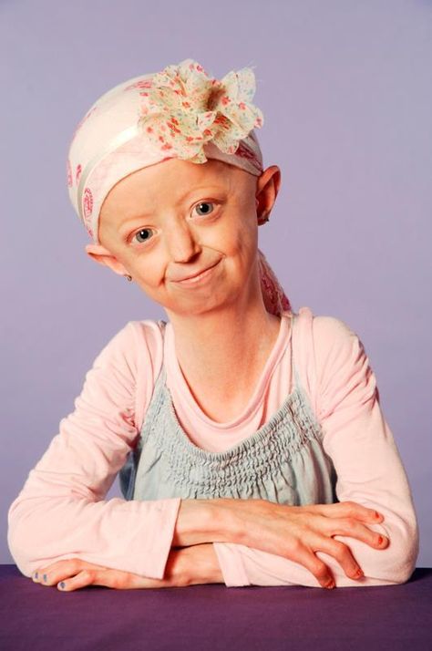 Hayley Okines, a British teenager with an extremely rare disease called progeria, died on Thursday at the age of 17 — exceeding doctors’ expectations that she would not live past 13. K9 Police Dogs, Police K9, Rare Disease, Art Competitions, Police Dogs, The Age, Disease, Baby Face, Parenting