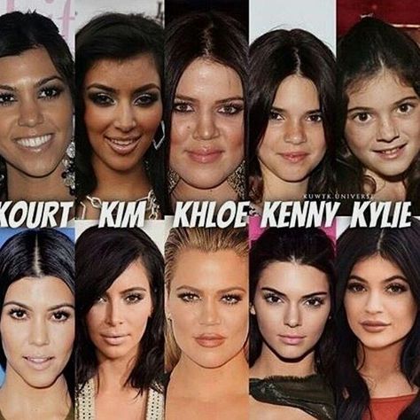 Kardashians Before And After, Kylie Jenner Drawing, Jenner Girls, Kloe Kardashian, The Fame, Glen Powell, Celebrity Plastic Surgery, Jenner Sisters, Celebrities Before And After