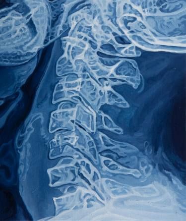 Saatchi Art Artist Anne Vincent Dijkstra; Painting, "X-ray V" #art Xray Art, V Art, Artistic Inspiration, Photorealism, Story Writing, New Energy, X Ray, Painting Oil, Blue Aesthetic