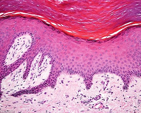 Shown here are human skin cells. The two dark pink layers at the top make up the epidermis, the tentacles reaching into the light pink dermis. The epidermis, or outer layer of skin, has four types of cells: keratinocytes give your skin strength, flexibility and waterproofing by producing keratin; melanocytes give your skin colour by producing melanin Cell Structure, Thermal Energy, Cotton Plant, Skin Tissue, Layers Of Skin, Anatomy And Physiology, Skin Color, Skin Cells, Dark Pink