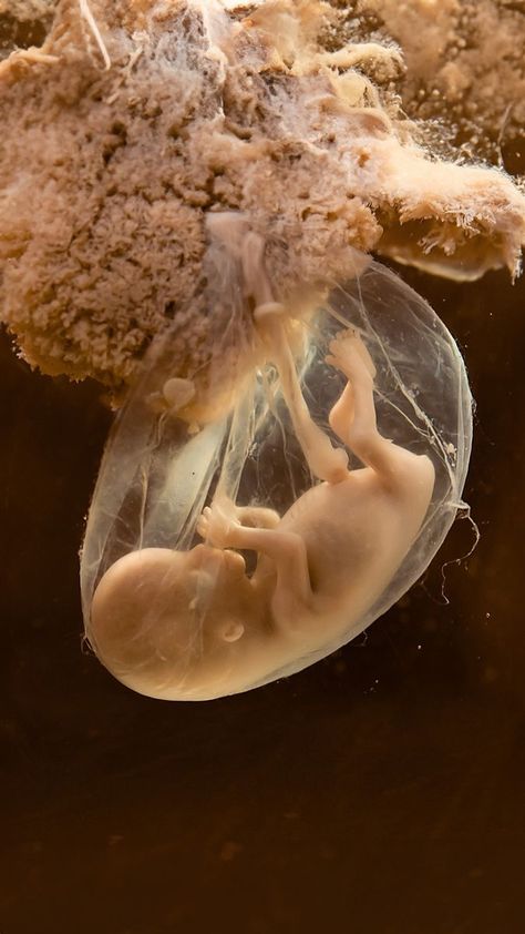 Human development and birth 😍 | Human development and birth 😍 | By Hashem Al-Ghaili | Facebook Human Embryo Development, Twins In The Womb, Somali Quotes, Human Embryo, Love Mom Quotes, Fetal Development, Human Development, Science Biology, Beautiful Quran Quotes