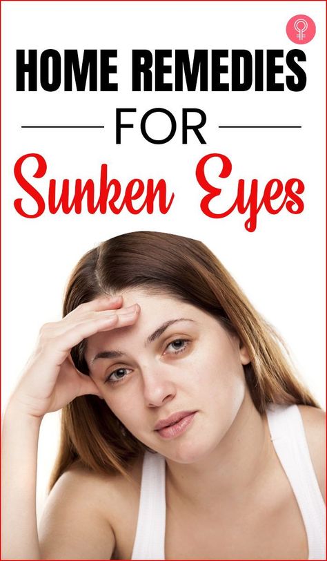 Dark Sunken Under Eyes, Dark Eyelids Remedy, How To Fix Sunken Eyes, Sunken Eyes Remedy Natural, Sunken Under Eyes Remedies, Under Eye Hollows Remedies, Hollow Under Eyes Remedies, Hollow Eyes Remedy, Sunken Eyes Remedy