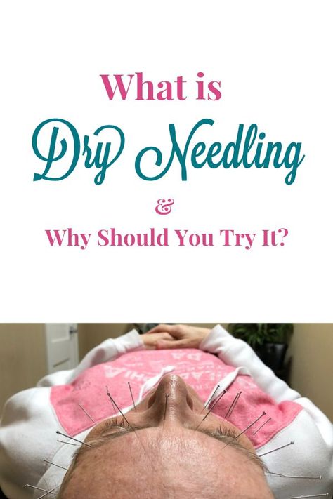 What is dry needling? How how this  is id different from acupuncture? Find out this technique can help you with your sinus issues!  #health #wellness #dryneedling #acupuncture #healthremedies #healing #sinus Dry Needling, Sinus Problems, Sinus Congestion, Doctor Advice, Health And Fitness Magazine, Healthy Diet Tips, Sinus Infection, Daily Health Tips, Fitness Advice