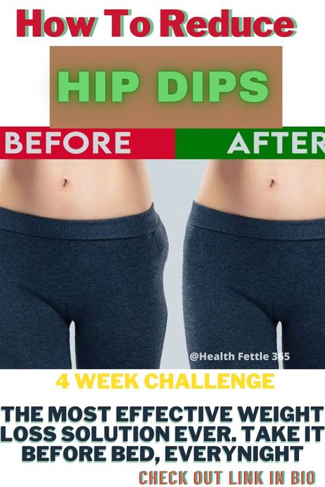 If you're wondering how to reduce hip dips, you're not alone. This common body concern can be tricky to fix, but there are a few things you can do to help minimize the appearance of hip dips.There are a few ways to reduce the appearance of hip dips. First, you can try to lose weight if you're carrying extra pounds. Even a few pounds can help minimize the appearance of hip dips.Another option is to build up the muscles around your hip area. This can help fill out the dips and make less noticeable Reduce Hip Dips, Hips Dips, Reduce Hips, You're Not Alone, Muscles, You Can Do, Health